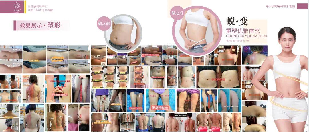 坚守健康底线：伊简梅以合规实践破解减肥市场乱象